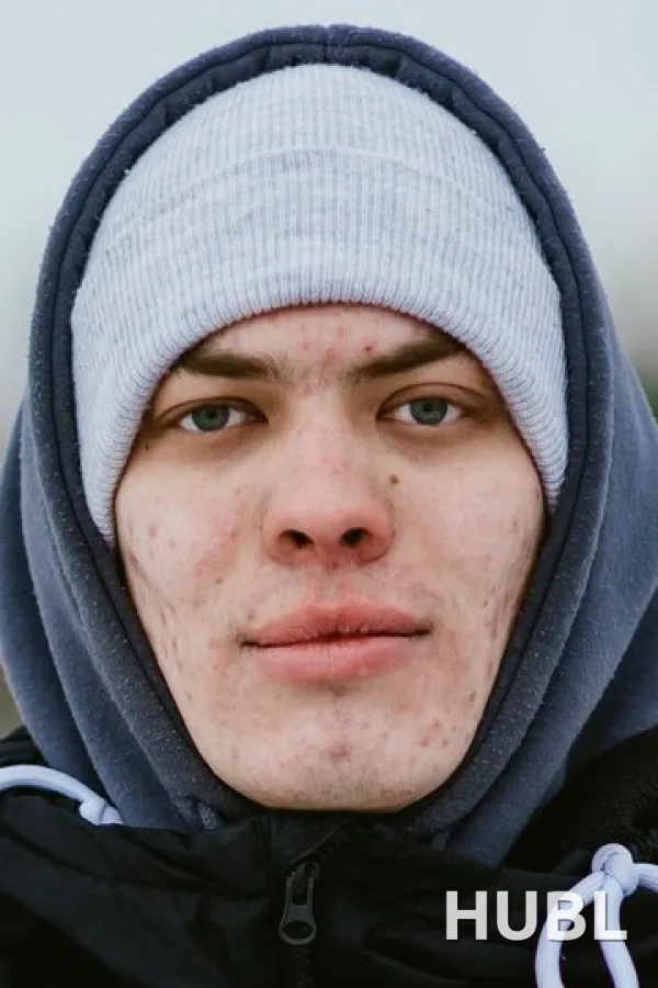 Алексей Верещагин